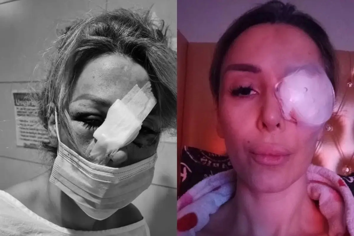 Romina Sáez cuando fue atacada y hace poco