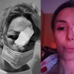 Romina Sáez cuando fue atacada y hace poco