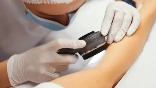 Melanoma: prevención y detección precoz son fundamentales
