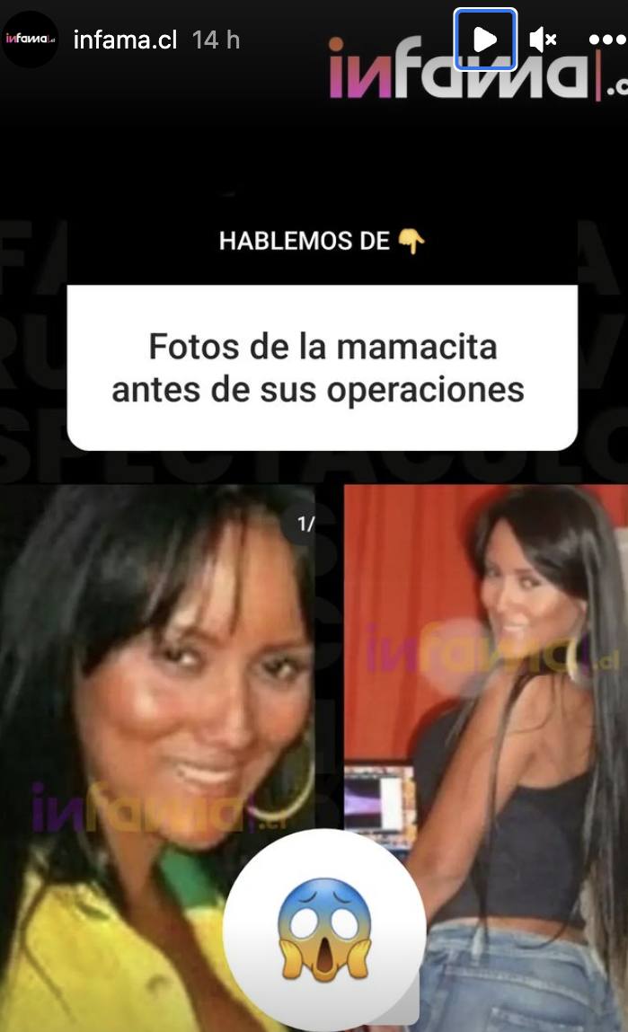 captura de las historias de Instagram de Infama / 