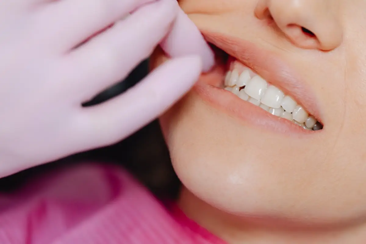 dientes