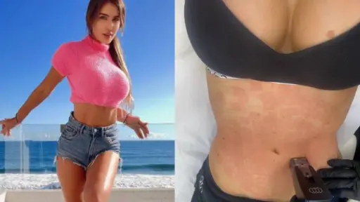 primer plano del abdomen de Fran Undurraga