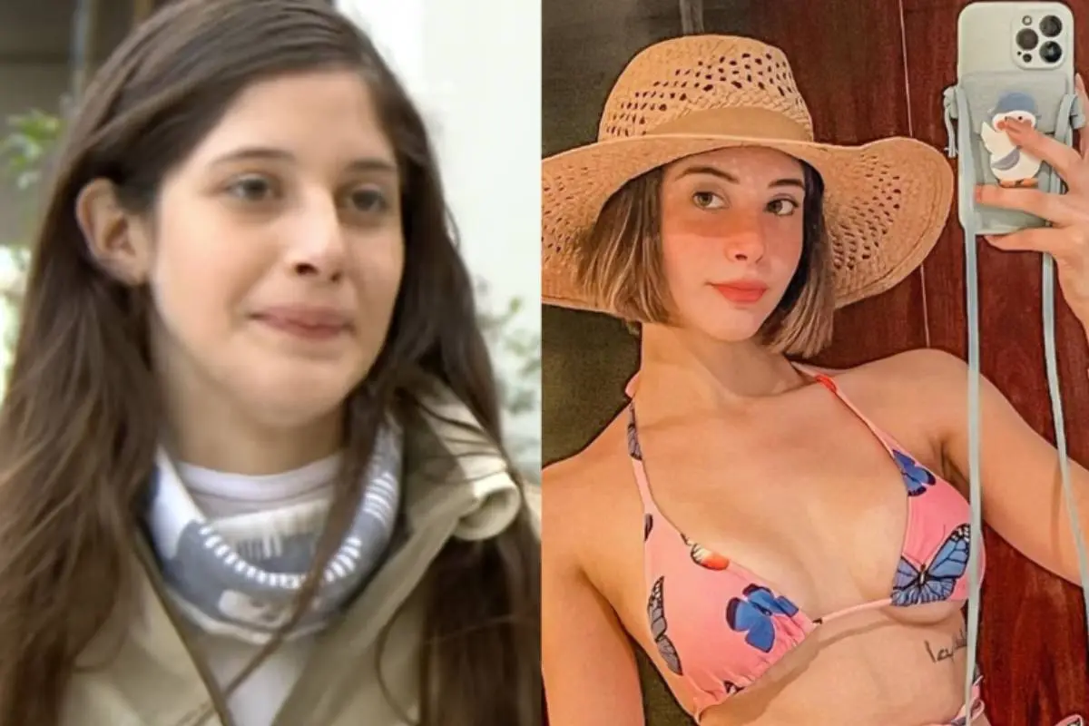 foto de Icata antes y después de su operación