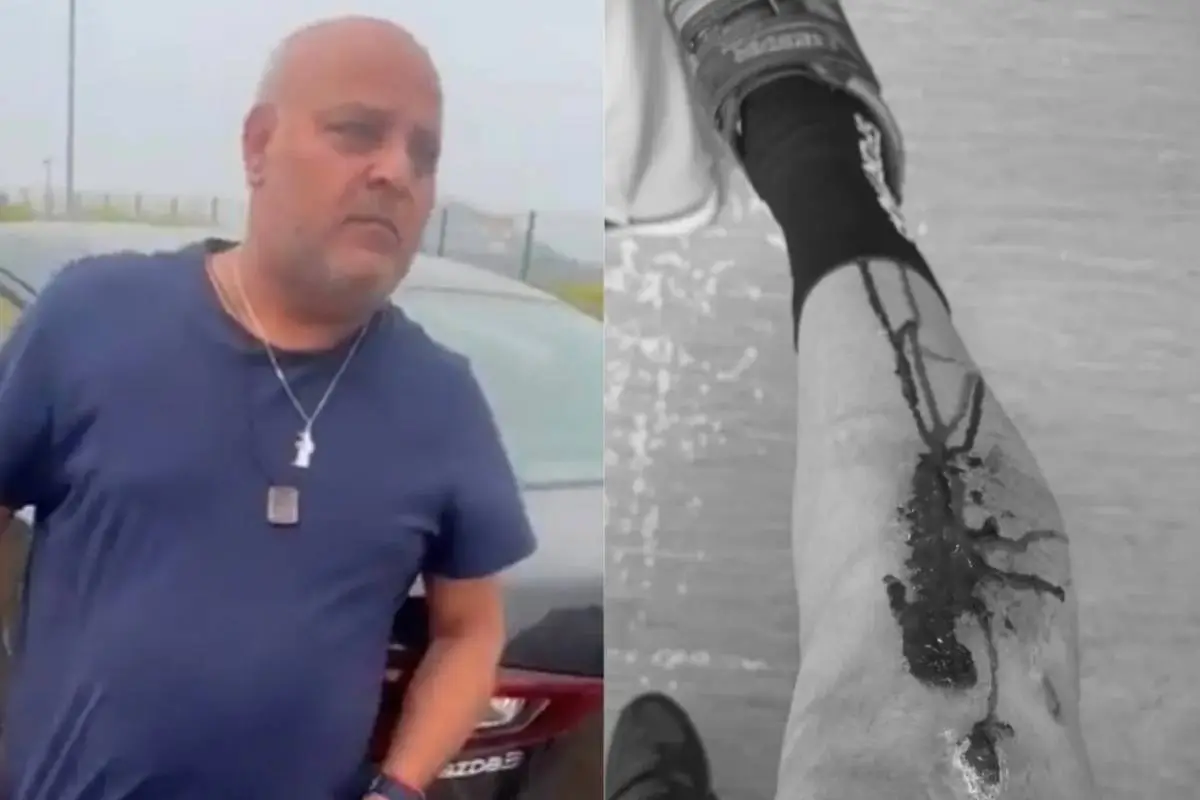 plano medio del periodista Miguel Acuña y pierna de ciclista atropellado