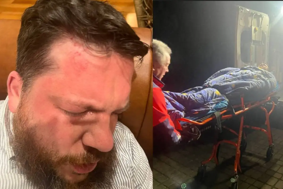 Leonid Volkov fue atacado con un martillo fuera de su casa, Ivan Zhdanov