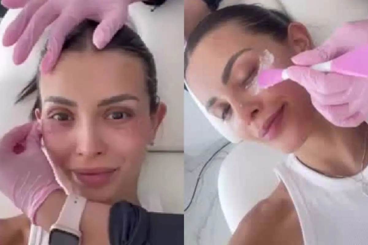 Cony Capelli y su tratamiento estético , Captura de redes sociales