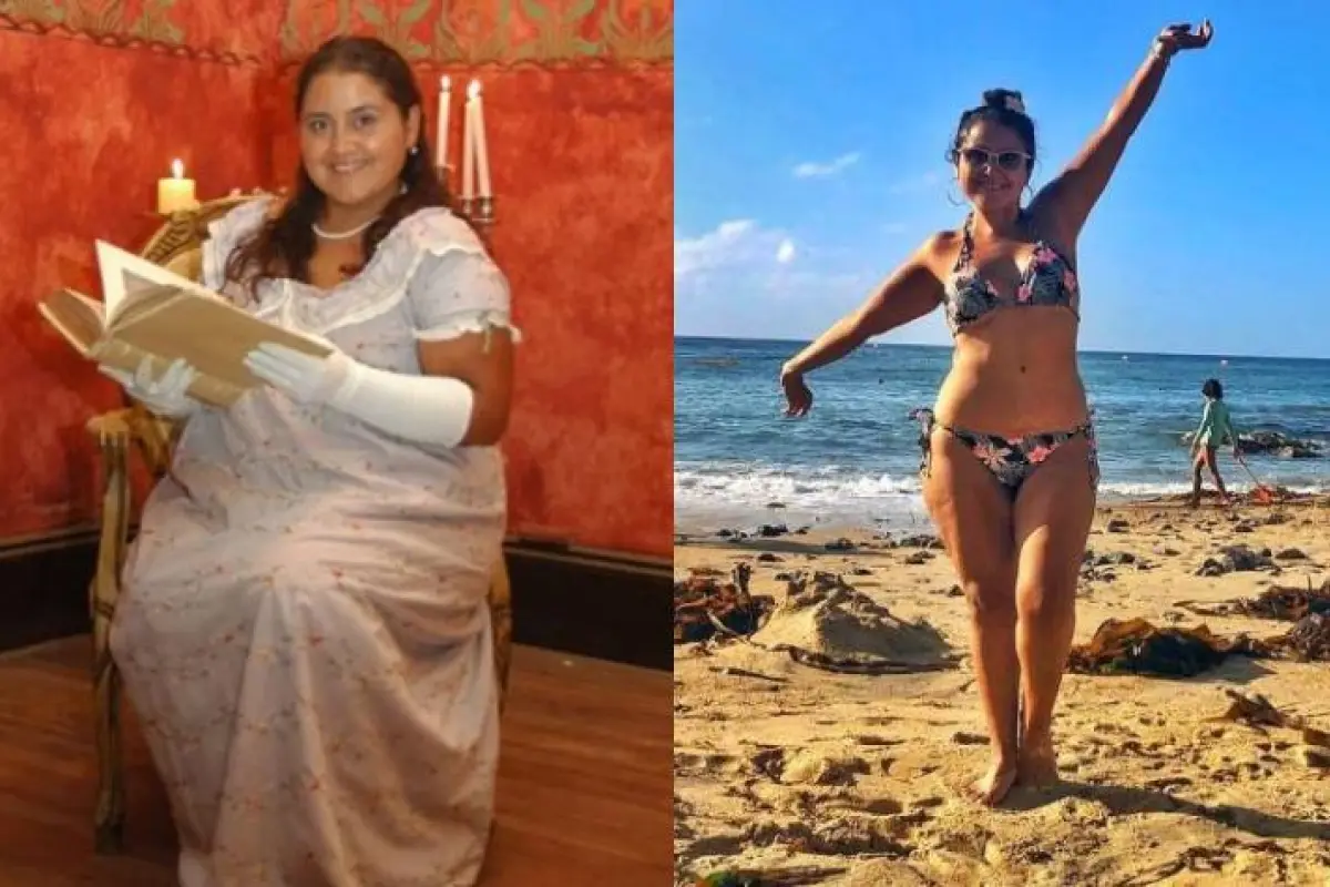 Pamela Leiva antes y después de la cirugía bariátrica, Redes sociales