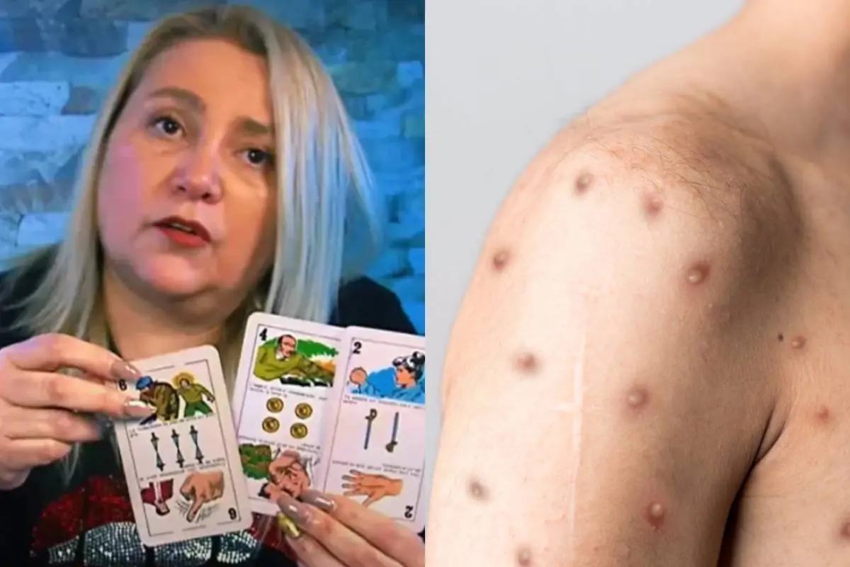 Latife Soto lanzó alarmante predicción sobre la viruela del mono, Redes sociales | Referencial