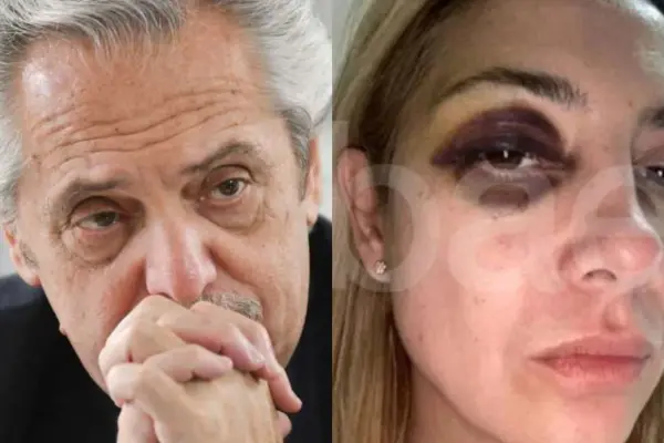 Alberto Fernández vive días difíciles en Argentina ,Captura