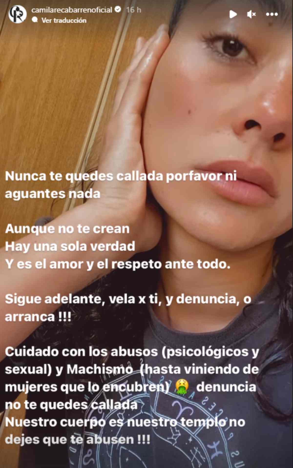 La agresión que sufrió Camila Recabarren por parte de su hermano - Instagram | Camila Recabarren