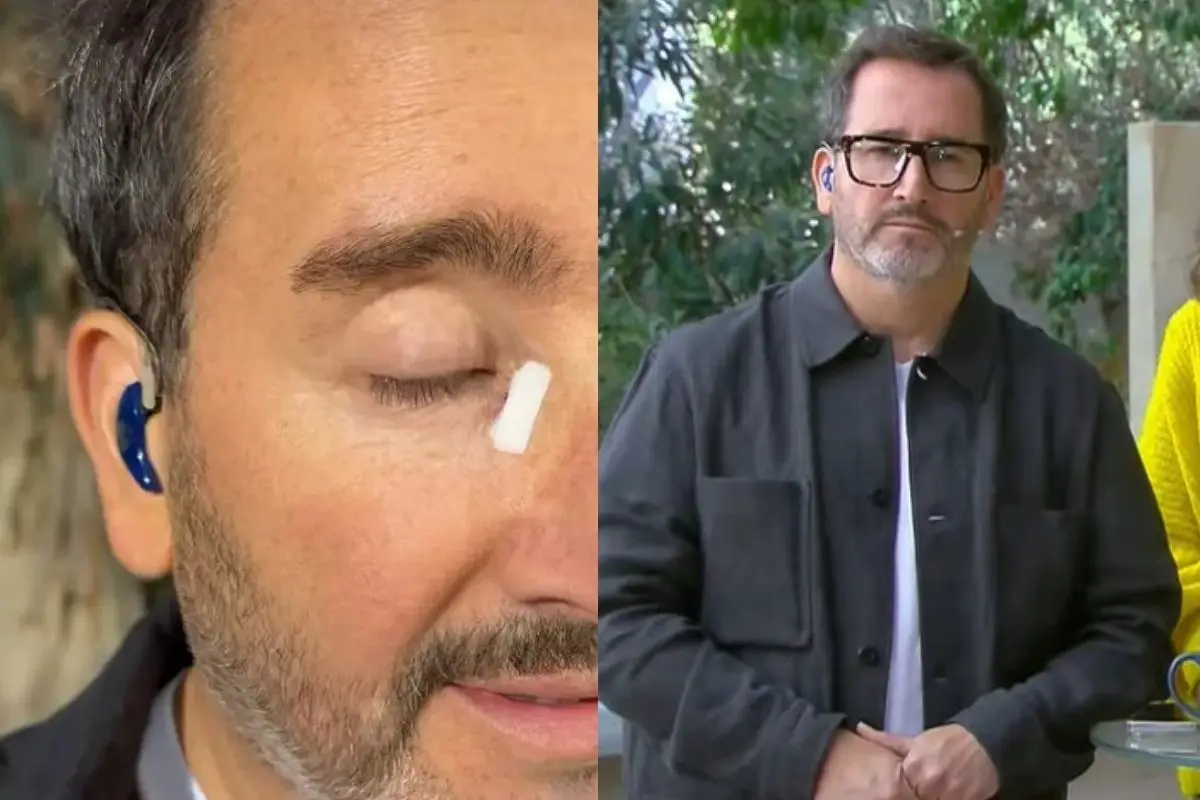 Eduardo Fuentes lució un notorio parche en su rostro, Captura