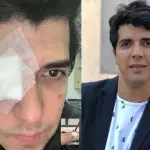 Roberto luce un enorme parche en su ojo lesionado, Instagram