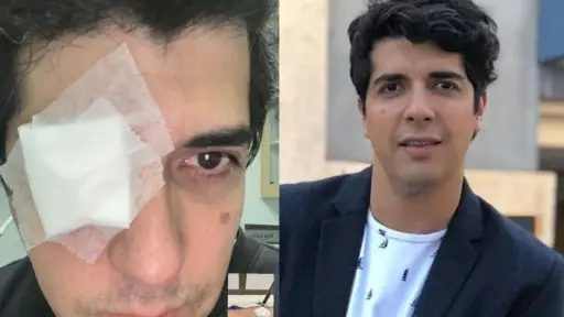 Roberto luce un enorme parche en su ojo lesionado, Instagram