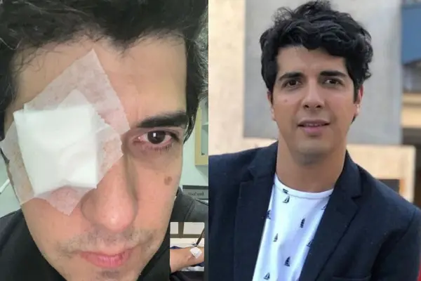 Roberto luce un enorme parche en su ojo lesionado ,Instagram