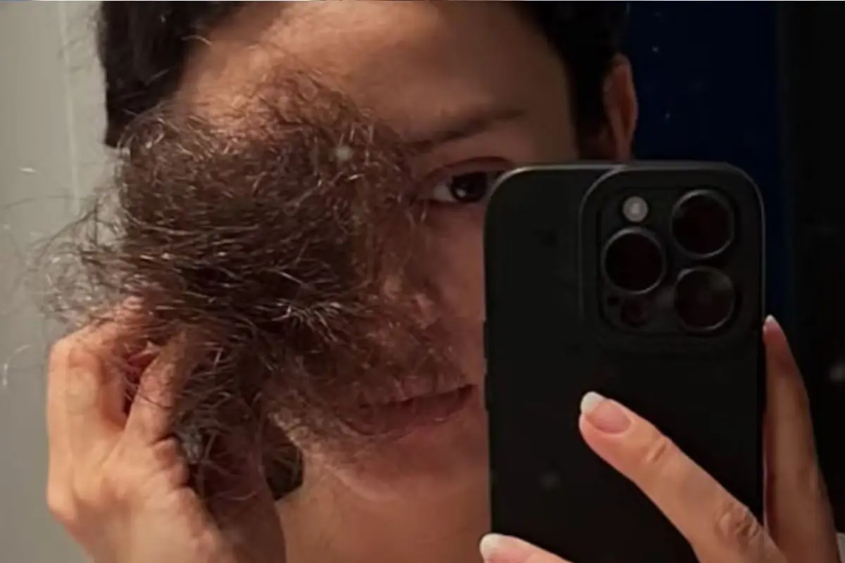 Karla Melo se sometió a quimioterapia, Instagram