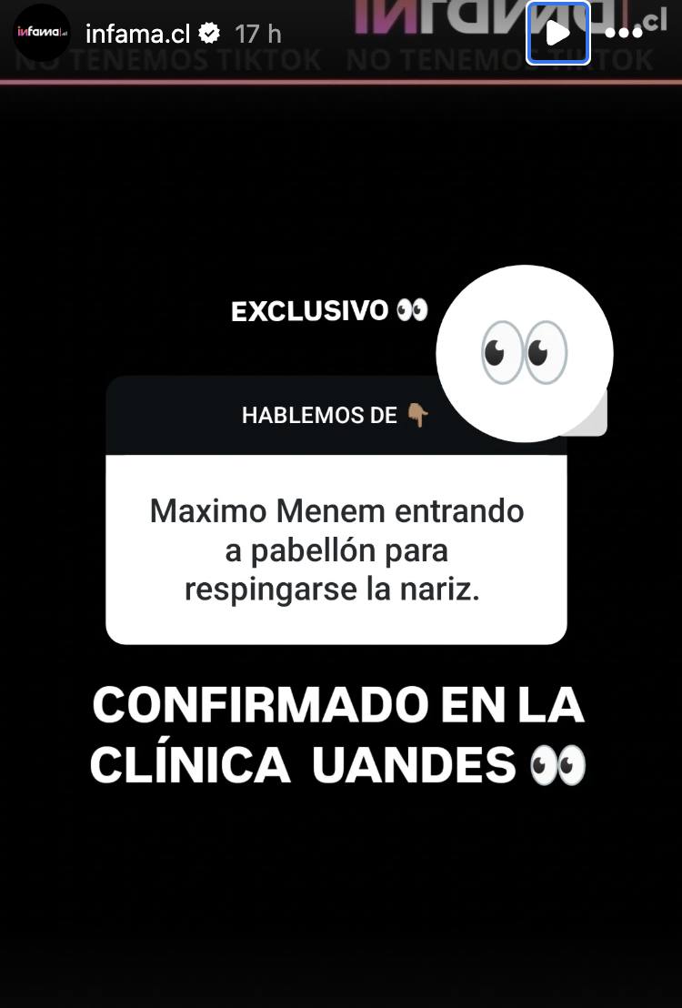 Máximo Bolocco se habría sometido a cirugía - Instagram