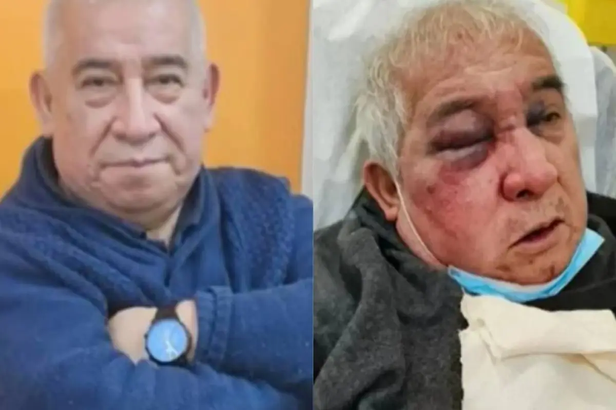 Conserje entregó detalles de la brutal golpiza que recibió, Redes sociales | Referencial