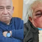 Conserje entregó detalles de la brutal golpiza que recibió, Redes sociales | Referencial