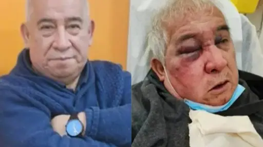 Conserje entregó detalles de la brutal golpiza que recibió, Redes sociales | Referencial