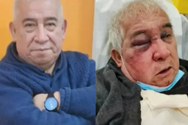 Conserje entregó detalles de la brutal golpiza que recibió ,Redes sociales | Referencial