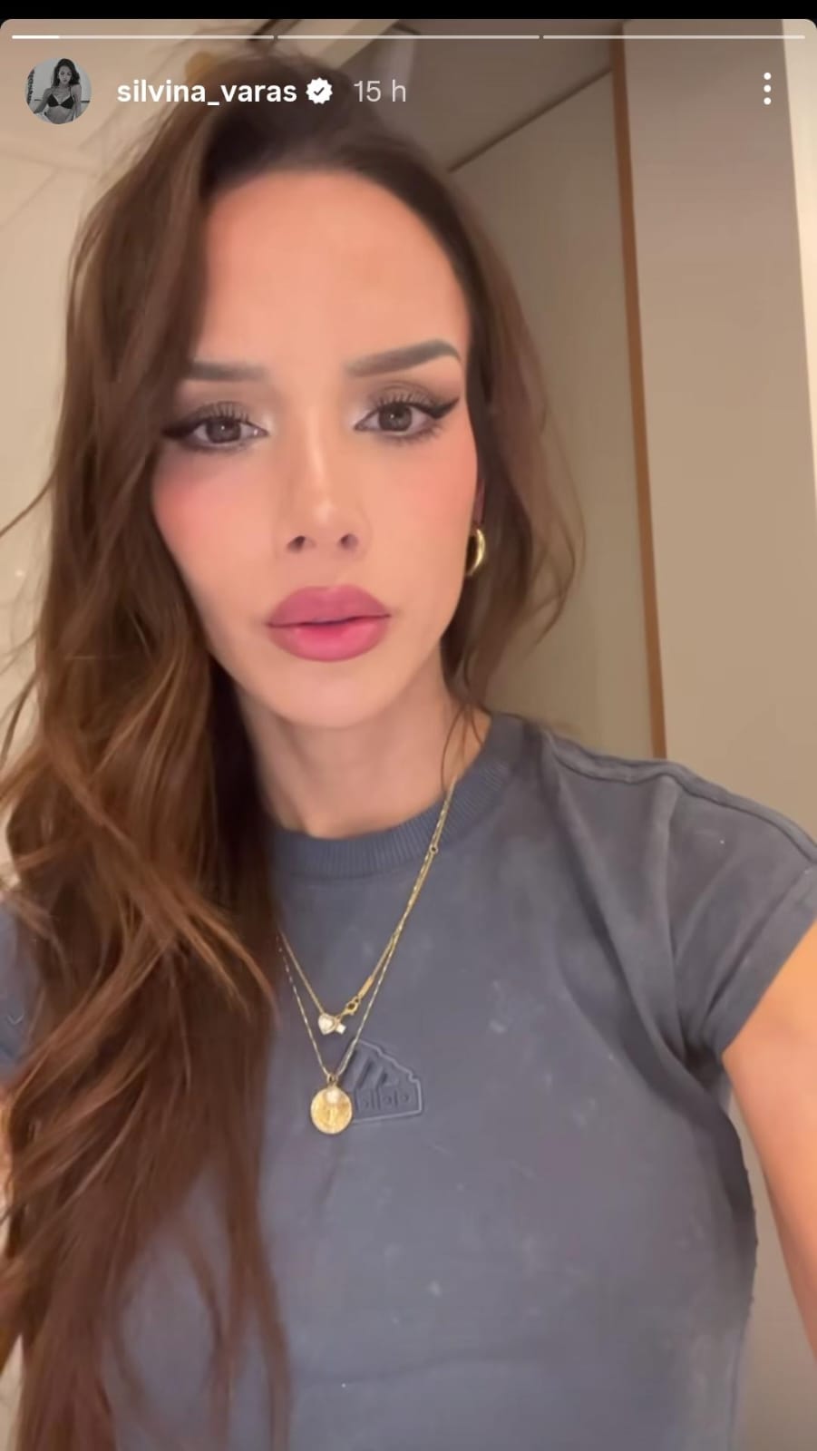 Silvina Varas  - Redes sociales 