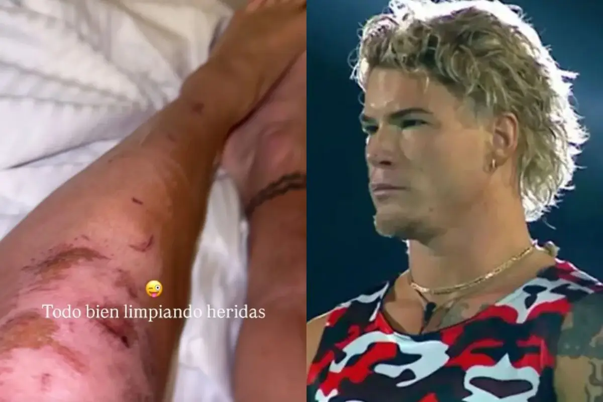 Raimundo Cerda terminó con sus piernas destruidas , Instagram