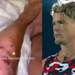 Raimundo Cerda terminó con sus piernas destruidas , Instagram