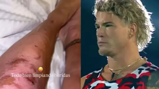 Raimundo Cerda terminó con sus piernas destruidas , Instagram