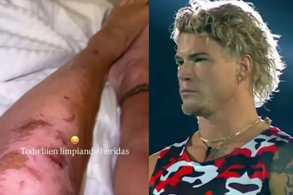 Raimundo Cerda terminó con sus piernas destruidas  ,Instagram