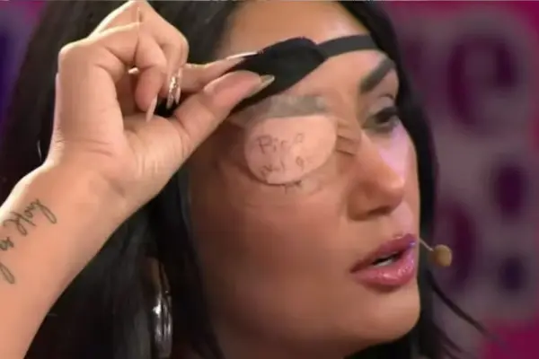 Pamela Díaz fue afectada por un chalazión ,Captura