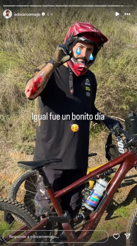 La fuerte caída que sufrió Edo Caroe  - Instagram | Edo Caroe