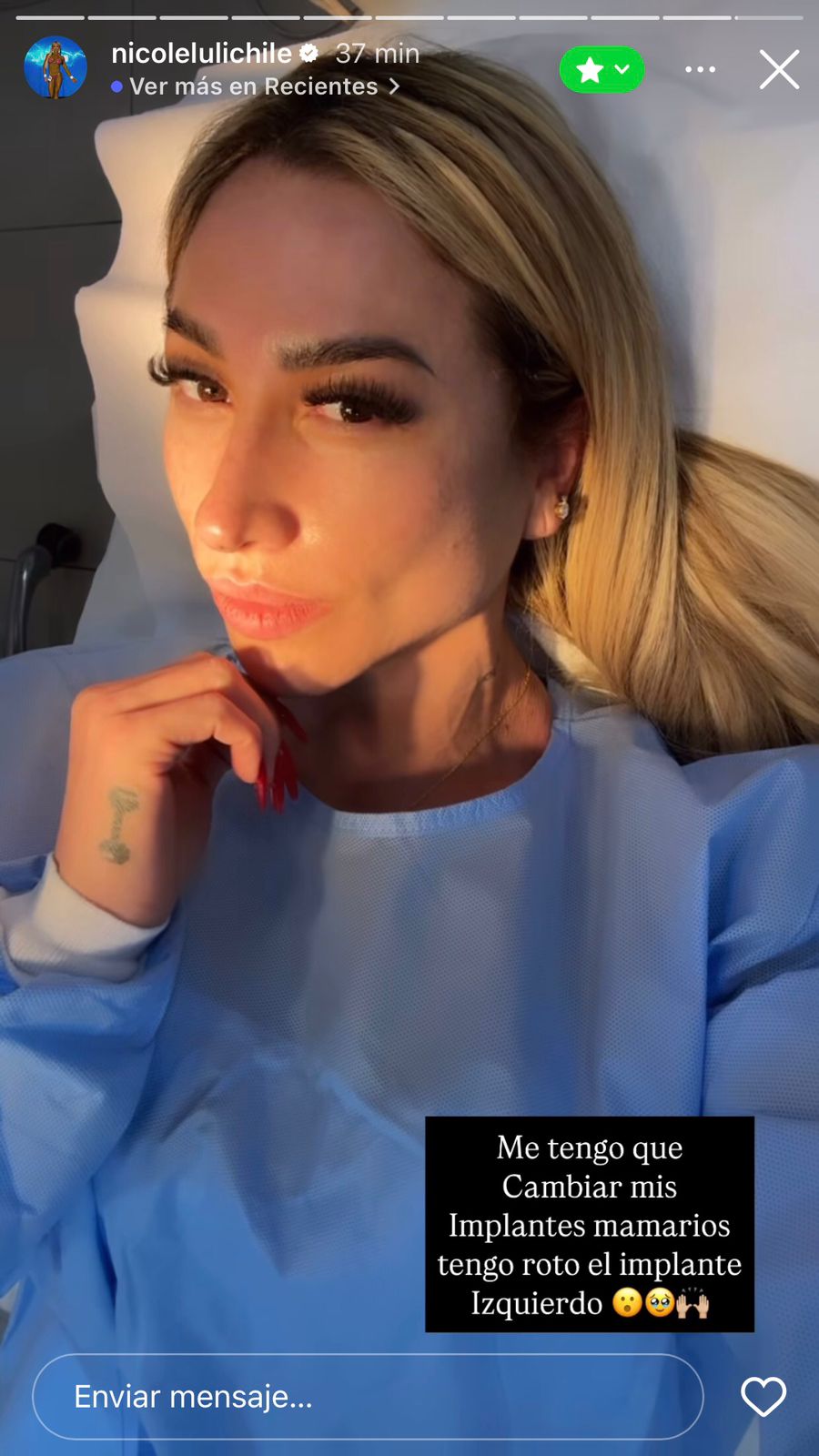 Nicole Moreno deberá someterse a una operación  - Nicole Moreno | Instagram