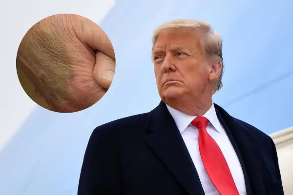 Donald Trump ,Archivo