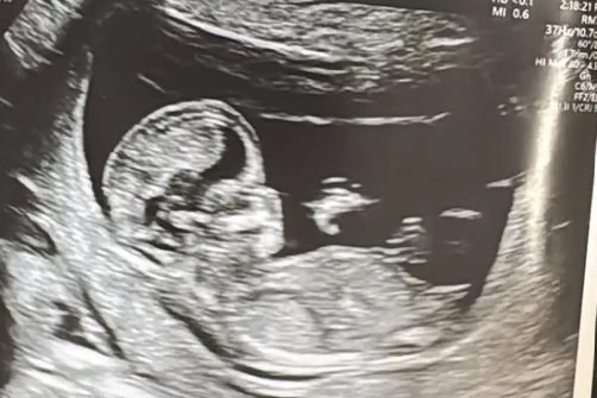 Francisco Sierralta, Instagram