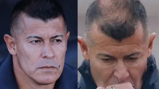 Jorge Almirón ha sufrido notoria pérdida de pelo, Instagram