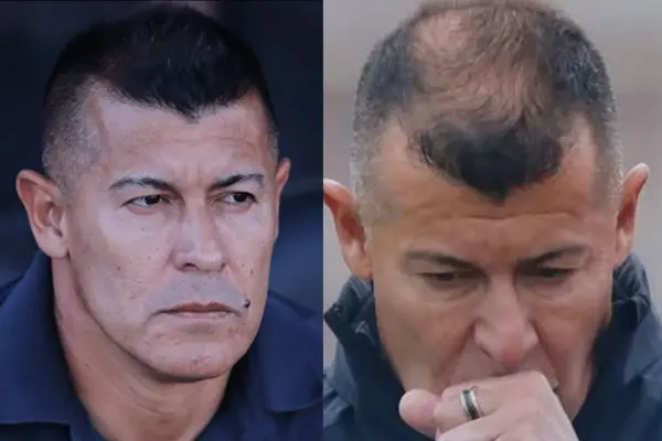 Jorge Almirón ha sufrido notoria pérdida de pelo ,Instagram