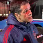 Michael Clark se mostró consternado, red X