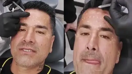 Kike Acuña