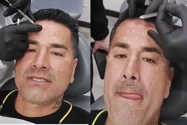 Kike Acuña