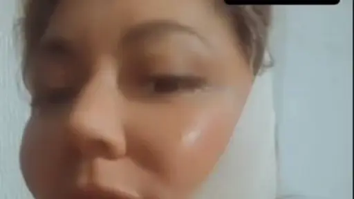 Denisse Campos operada, Redes Sociales