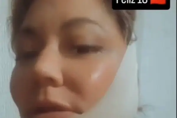 Denisse Campos operada ,Redes Sociales