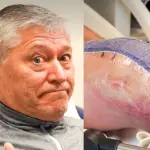Patricio Yáñez sufrió con su rodilla, Instagram