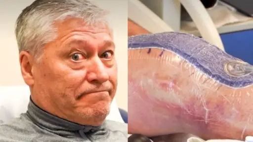 Patricio Yáñez sufrió con su rodilla, Instagram