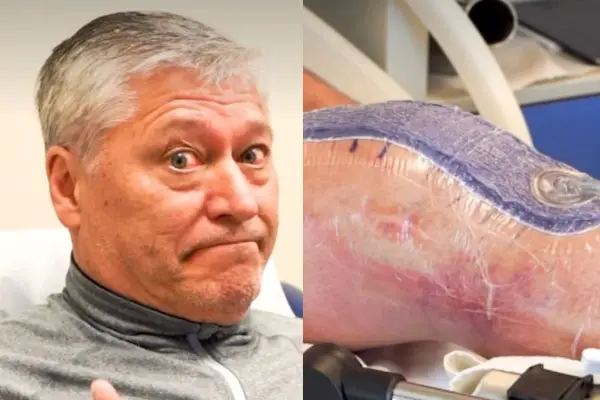 Patricio Yáñez sufrió con su rodilla ,Instagram