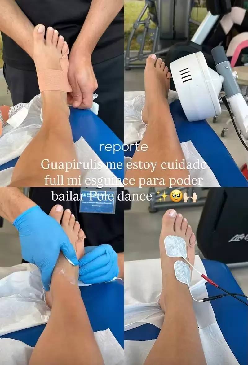 Daniela Castro y su lesión  - Daniela Castro | Instagram