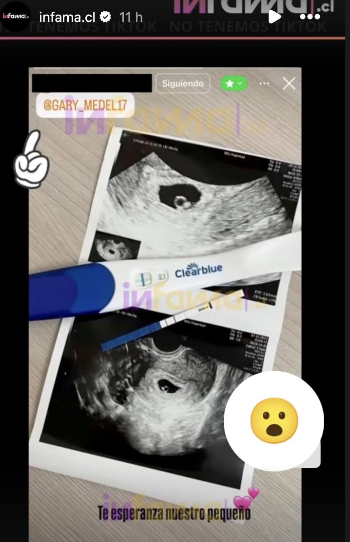 Gary Medel - Instagram de Infama