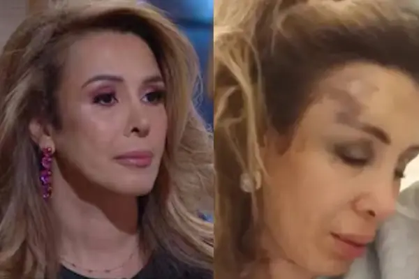 Romina Sáez fue brutalmente agredida en discoteque ,Referencial | Captura