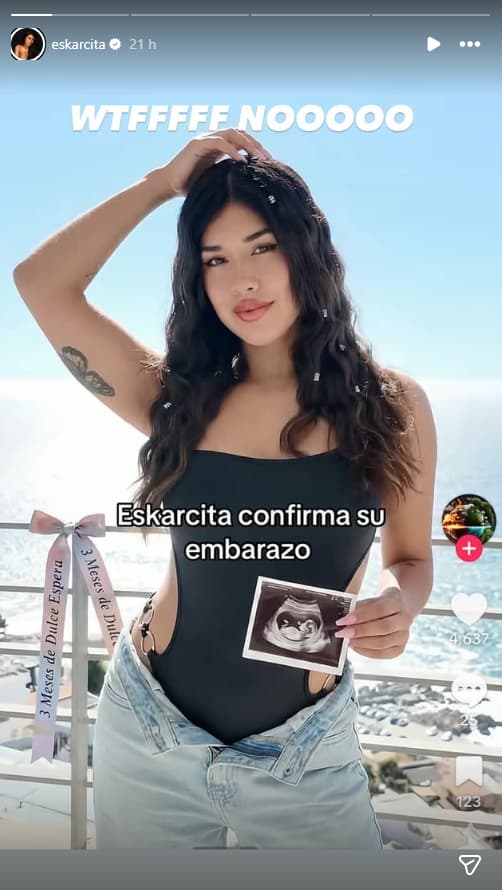 Eskarcita aclaró supuesta embarazo  - Eskarcita | Instagram