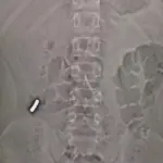 Insólito desafío en redes sociales, Instagram