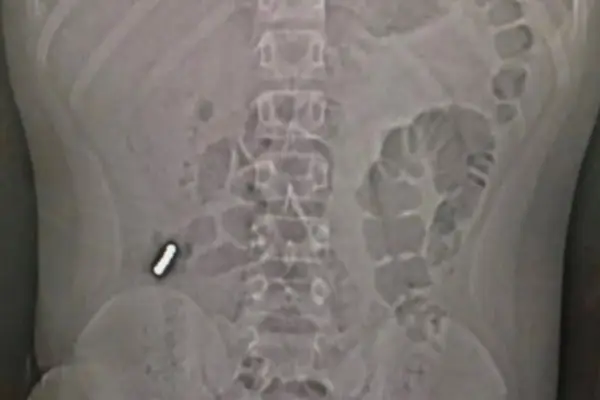 Insólito desafío en redes sociales ,Instagram